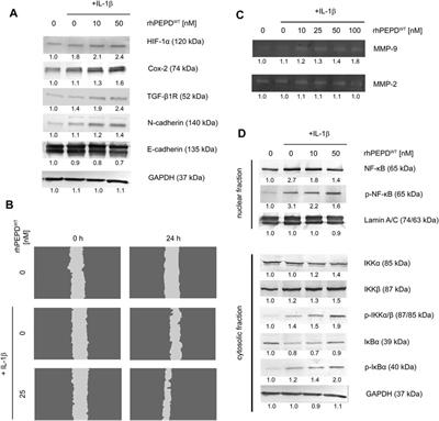 Recombinant Prolidase Activates EGFR-Dependent Cell Growth in an Experimental Model of Inflammation in HaCaT Keratinocytes. Implication for Wound Healing